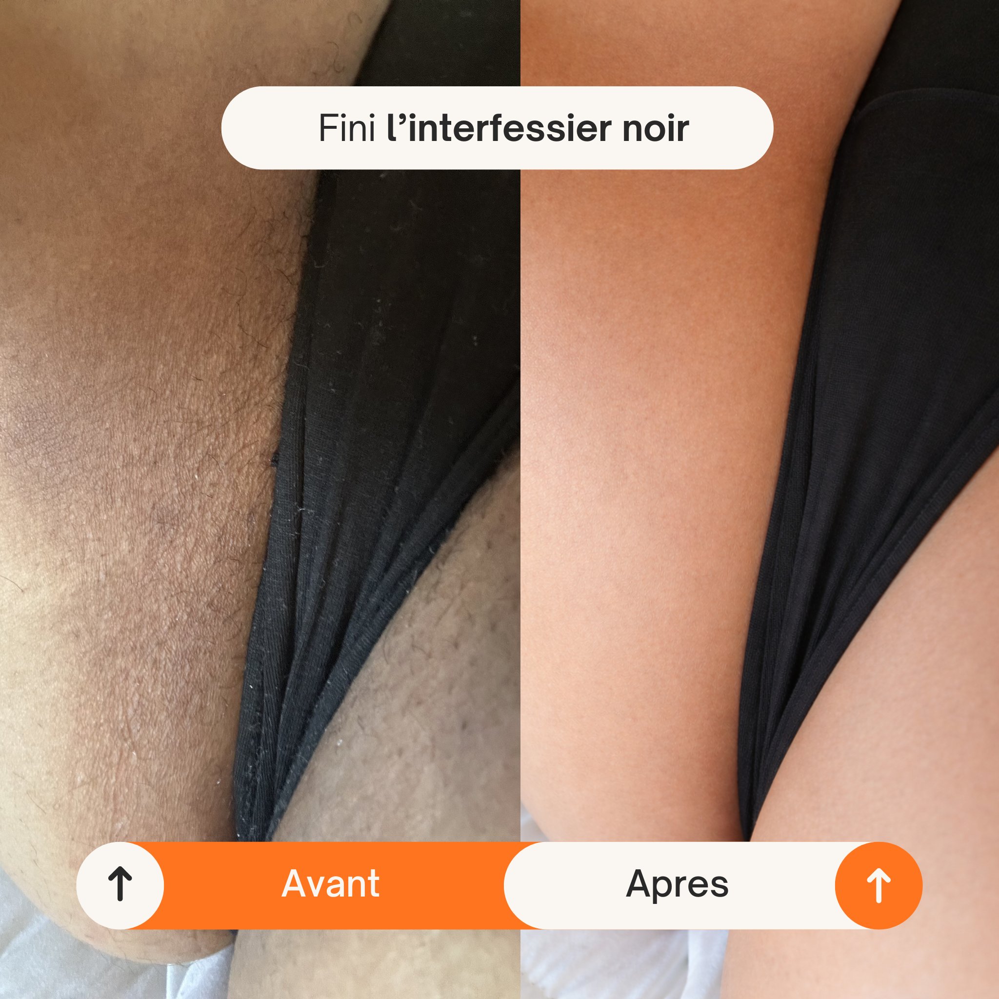 Spray Éclat Corps Kojic Acid + Curcuma