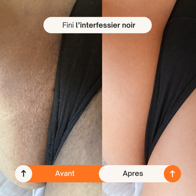 Spray Éclat Corps Kojic Acid + Curcuma