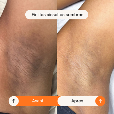 Spray Éclat Corps Kojic Acid + Curcuma