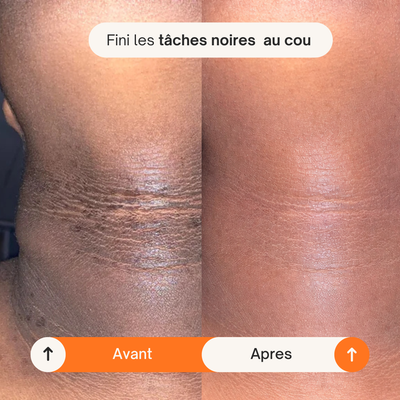 Spray Éclat Corps Kojic Acid + Curcuma