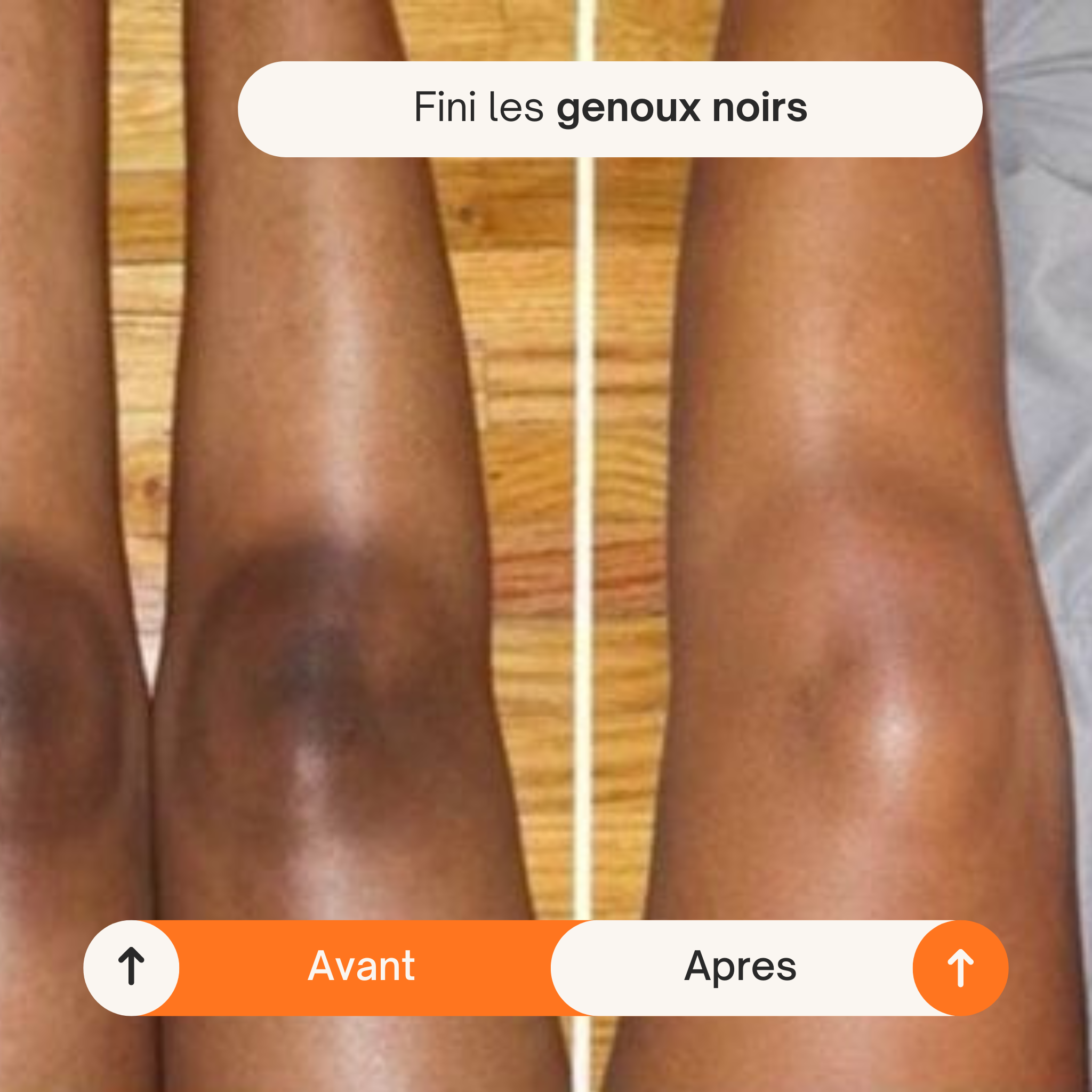 Spray Éclat Corps Kojic Acid + Curcuma