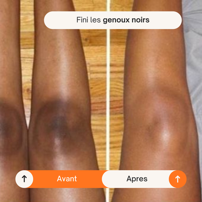 Spray Éclat Corps Kojic Acid + Curcuma